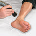Zimmer Cryo 6 cryotherapy device hose used for targeted cold air delivery during skin cooling and cold therapy treatments